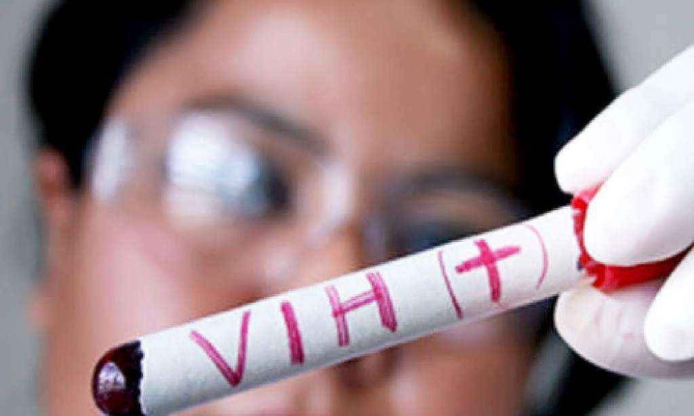 Más de 1300 pacientes venezolanos infectados con VIH llegan a Perú. Foto: Agencias