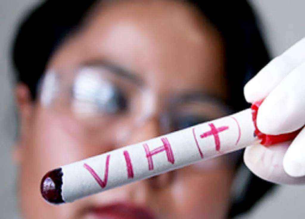 Más de 1300 pacientes venezolanos infectados con VIH llegan a Perú. Foto: Agencias