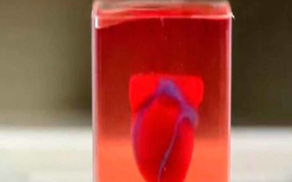 primer corazón impreso en 3D- acn