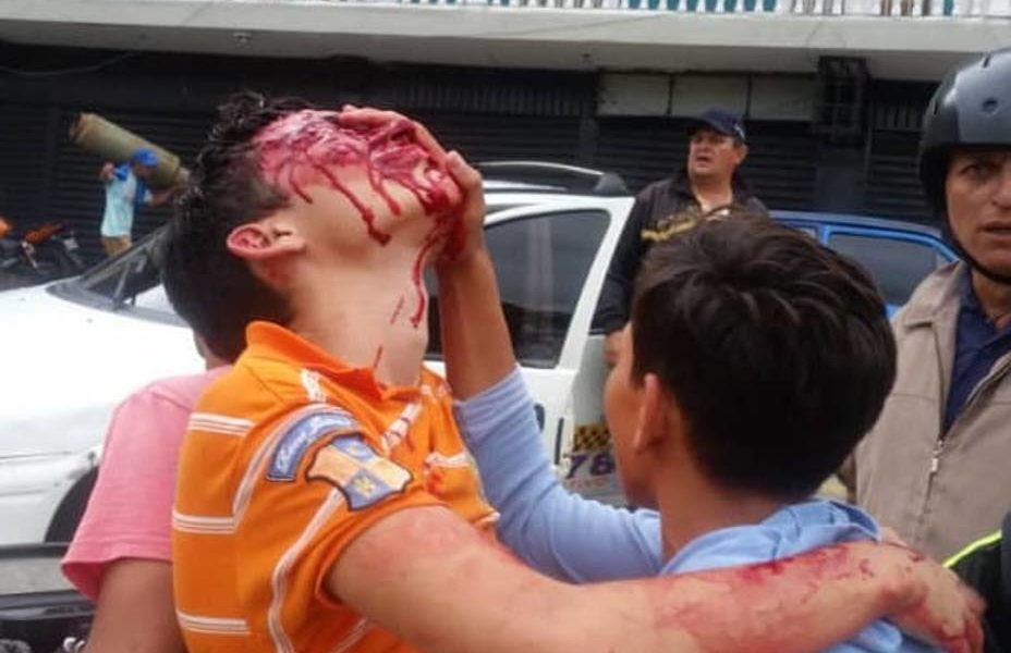 adolescente perdió la vista por disparo de perdigón en el estado Táchira. ACN