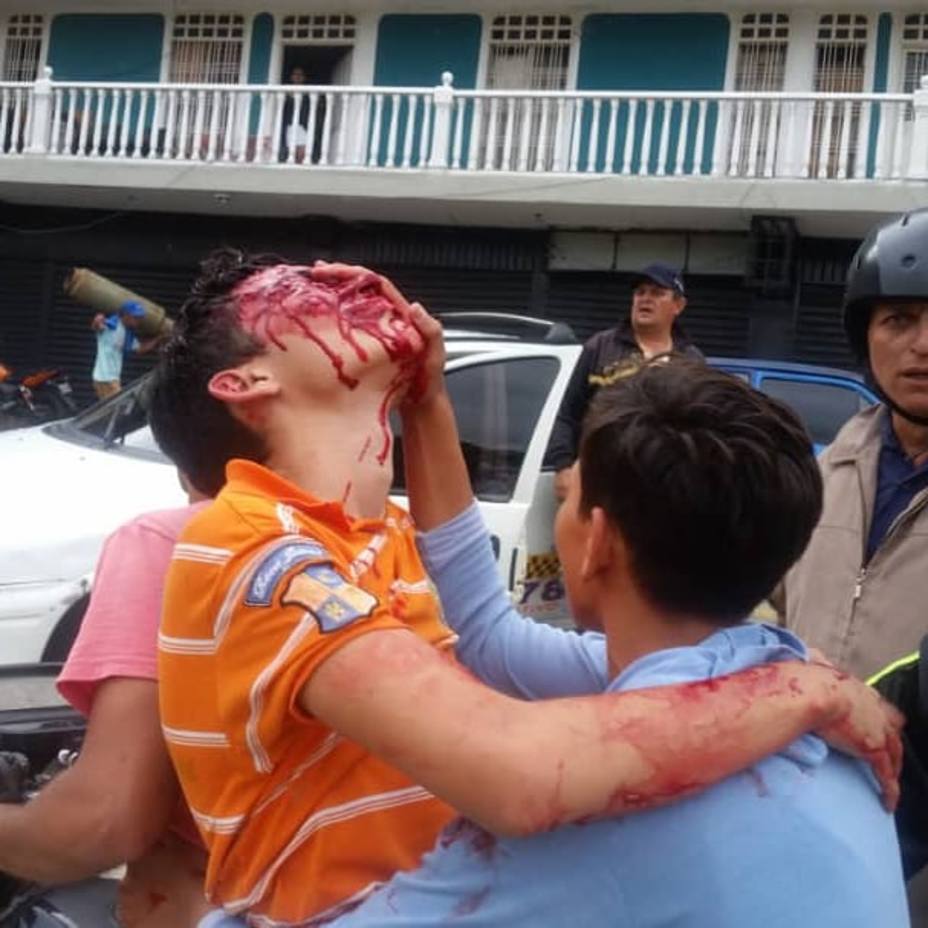 adolescente perdió la vista por disparo de perdigón en el estado Táchira. ACN