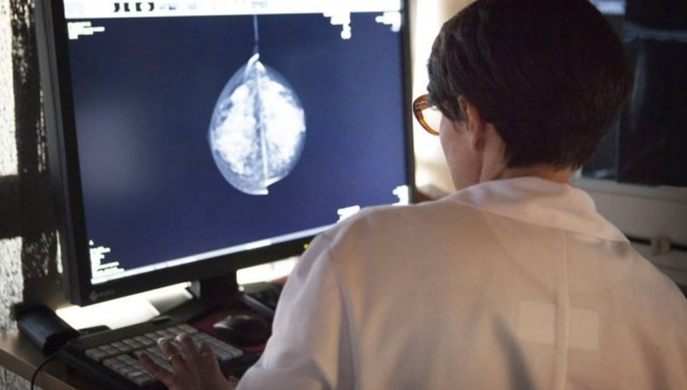 Inteligencia artificial de Google detecta el cáncer de seno mejor que radiólogos