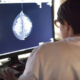 Inteligencia artificial de Google detecta el cáncer de seno mejor que radiólogos