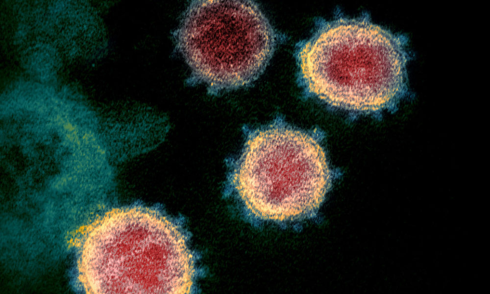 Coronavirus sobrevive a más de 60 grados