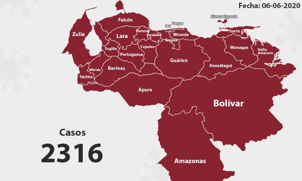 171 nuevos casos de coronavirus en Venezuela