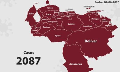 Venezuela acumula 2087 casos - noticiasACN