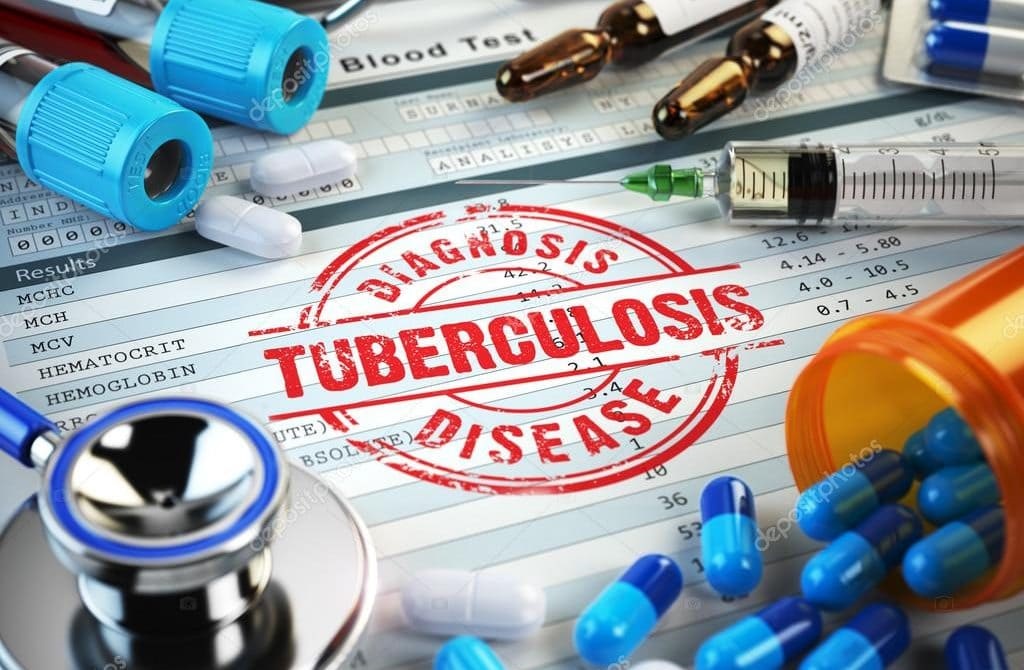 46 sanitarios se infectaron de tuberculosis - noticiacn