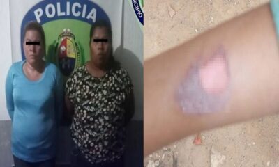 detenidas mujeres quemar niña Zulia-acn