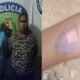 detenidas mujeres quemar niña Zulia-acn
