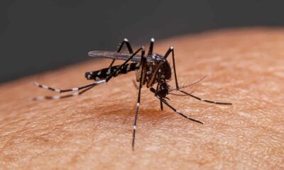 40 casos de dengue Venezuela-acn