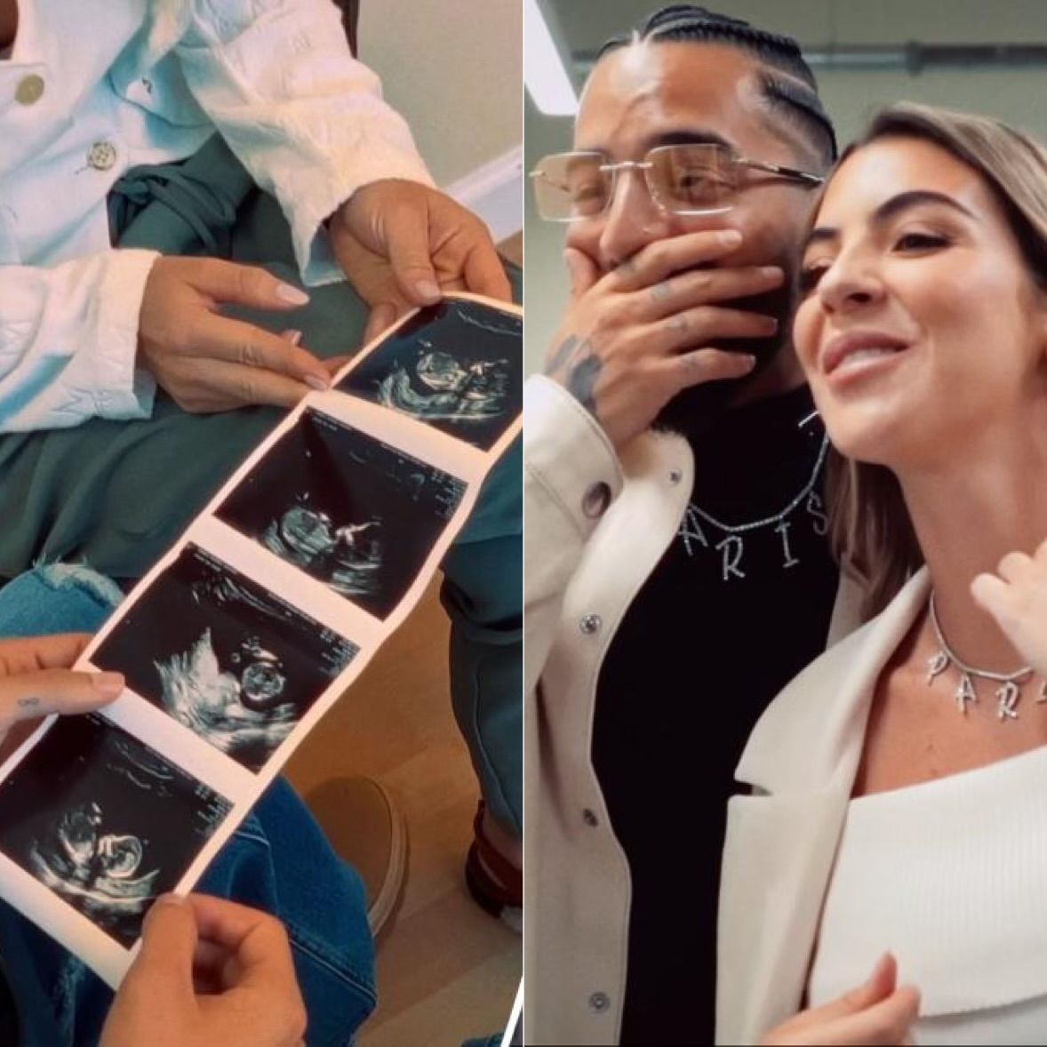 Maluma será padre de una niña-acn