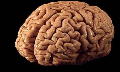 implante cerebral con IA ayuda a hombre a comunicarse - Agencia Carabobeña de Noticias - Agencia ACN- Noticias Carabobo