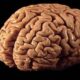 implante cerebral con IA ayuda a hombre a comunicarse - Agencia Carabobeña de Noticias - Agencia ACN- Noticias Carabobo