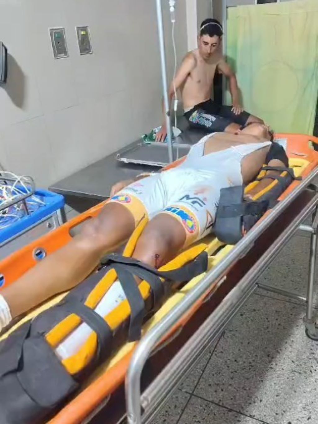 Motorizado arrolla a ciclistas en Mérida - Agencia Carabobeña de Noticias