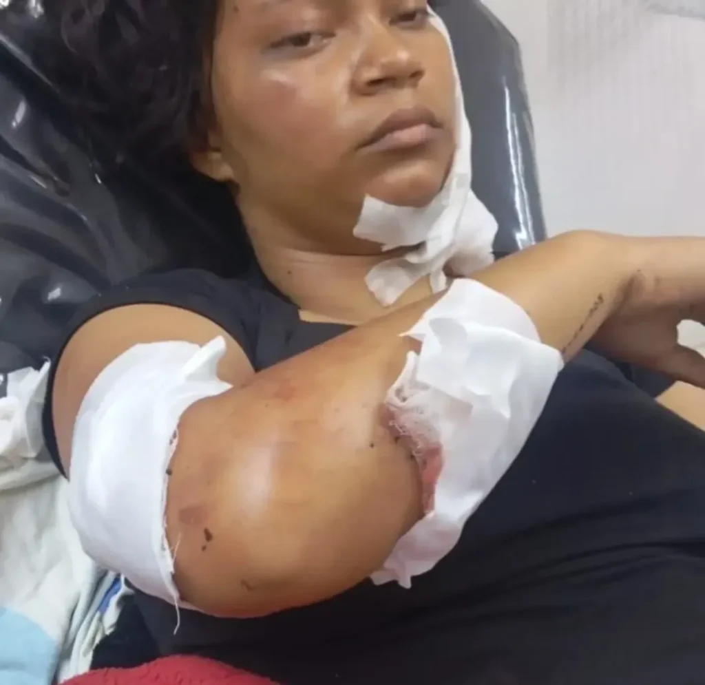 le dio 16 puñaladas a su expareja - Agencia Carabobeña de Noticias